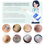 Load image into Gallery viewer, SERUM REPARATEUR DES ONGLES
