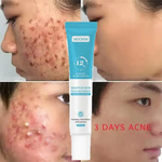 Load image into Gallery viewer, Gel Anti-Acné à l'Acide Salicylique – Une peau plus nette, plus lisse et plus éclatante
