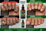 Load image into Gallery viewer, SERUM REPARATEUR DES ONGLES
