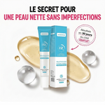 Load image into Gallery viewer, Gel Anti-Acné à l'Acide Salicylique – Une peau plus nette, plus lisse et plus éclatante
