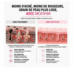 Load image into Gallery viewer, Gel Anti-Acné à l'Acide Salicylique – Une peau plus nette, plus lisse et plus éclatante
